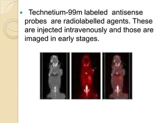 Duchene muscular dystrophy