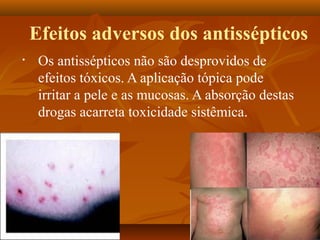 Efeitos adversos dos antissépticos
•    Os antissépticos não são desprovidos de
     efeitos tóxicos. A aplicação tópica pode
     irritar a pele e as mucosas. A absorção destas
     drogas acarreta toxicidade sistêmica.
 