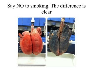 Say NO to smoking. The difference is
clear

 