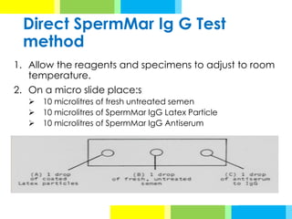 Direct SpermMar Ig G Test
method
1. Allow the reagents and specimens to adjust to room
temperature.
2. On a micro slide place:s
➢ 10 microlitres of fresh untreated semen
➢ 10 microlitres of SpermMar IgG Latex Particle
➢ 10 microlitres of SpermMar IgG Antiserum
 