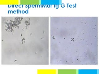 Direct SpermMar Ig G Test
method
 