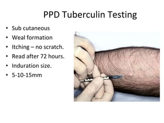 Anti tb drugs | PPT