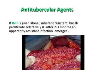 Antitubercular AgentsAntitubercular Agents
- If INH is given alone , inherent resistant bacilli
proliferate selectively & after 2-3 months an
apparently resistant infection emerges .
 