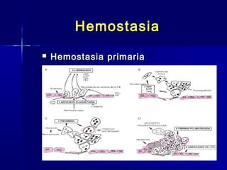 HHeemmoossttaassiiaa 
 HHeemmoossttaassiiaa pprriimmaarriiaa 
 