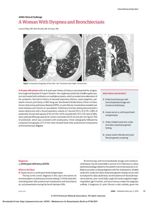 A Woman With Dyspnea and Bronchiectasis
Leonard Riley, MD; Mark Brantly, MD; Ali Ataya, MD
A 41-year-old woman with an 8–pack-year history of tobacco use presented for progres-
sivecoughanddyspneaof4years’duration.Hercoughwasproductiveofyellow-greenspu-
tumandtreatedwithantibioticsonmultipleoccasions,whichprovidedsomealleviationof
her symptoms. She had no history of neonatal respiratory distress, nasal congestion, per-
sistent urticaria, joint laxity, or illicit drug use. She denied a family history of liver cirrhosis,
chronicobstructivepulmonarydisease(COPD),orcysticfibrosis.Examinationrevealedscat-
tered wheezes and rhonchi on auscultation. Pulmonary function testing demonstrated a
severe obstruction with a forced expiratory volume at 1 second (FEV1) of 0.79 L (28% of
predicted),forcedvitalcapacity(FVC)of1.64L(47%ofpredicted),FEV1:FVCratioof48%,
and a reduced diffusing capacity for carbon monoxide of 8.74 mL/min per mm Hg (23.75%
of predicted), which was consistent with emphysema. Chest radiography followed by
computed tomography (CT) of the chest showed lower lobe predominant emphysema
and bronchiectasis (Figure).
Diagnosis
α1-Antitrypsin deficiency (AATD)
What to Do Next
B. Assess serum α1-antitrypsin level and genotype
The key to the correct diagnosis in this case is the severe ob-
structivepatternonpulmonaryfunctiontesting,CTofthechestdem-
onstrating lower lobe predominant emphysema and bronchiecta-
sis, and presentation during the fourth decade of life.
Bronchoscopy with bronchoalveolar lavage and transbron-
chial biopsy may be reasonable in pursuit of an infectious or ciliary
dyskinesiaetiologyrelatedtothispatient’sbronchiectasisbutisun-
likely to provide a unifying diagnosis with her emphysema. Inhaled
nasal nitric oxide and ciliary dyskinesia genetic testing can be used
toevaluateforciliarydyskinesia,buttheabsenceofneonatalrespi-
ratorydistress,year-rounddailycoughandnasalcongestionbegin-
ning before age 6 months, and situs inversus makes this diagnosis
unlikely. A diagnosis of cystic fibrosis is also unlikely, given the
Figure. Computed tomography of the chest. Left, Transverse view. Right, Coronal view.
WHAT WOULD YOU DO NEXT?
A. Order bronchoscopy with
bronchoalveolar lavage and
transbronchial biopsy
B. Assess serum α1-antitrypsin level
and genotype
C. Order inhaled nasal nitric oxide
and ciliary dyskinesia genetic
testing
D. Assess sweat chloride and cystic
fibrosis genetic screening
Clinical Review & Education
JAMA Clinical Challenge
jama.com (Reprinted) JAMA Published online July 5, 2019 E1
© 2019 American Medical Association. All rights reserved.
Downloaded From: https://jamanetwork.com/ AIIMS – Bhubaneswar by Ramachandra Barik on 07/06/2019
 