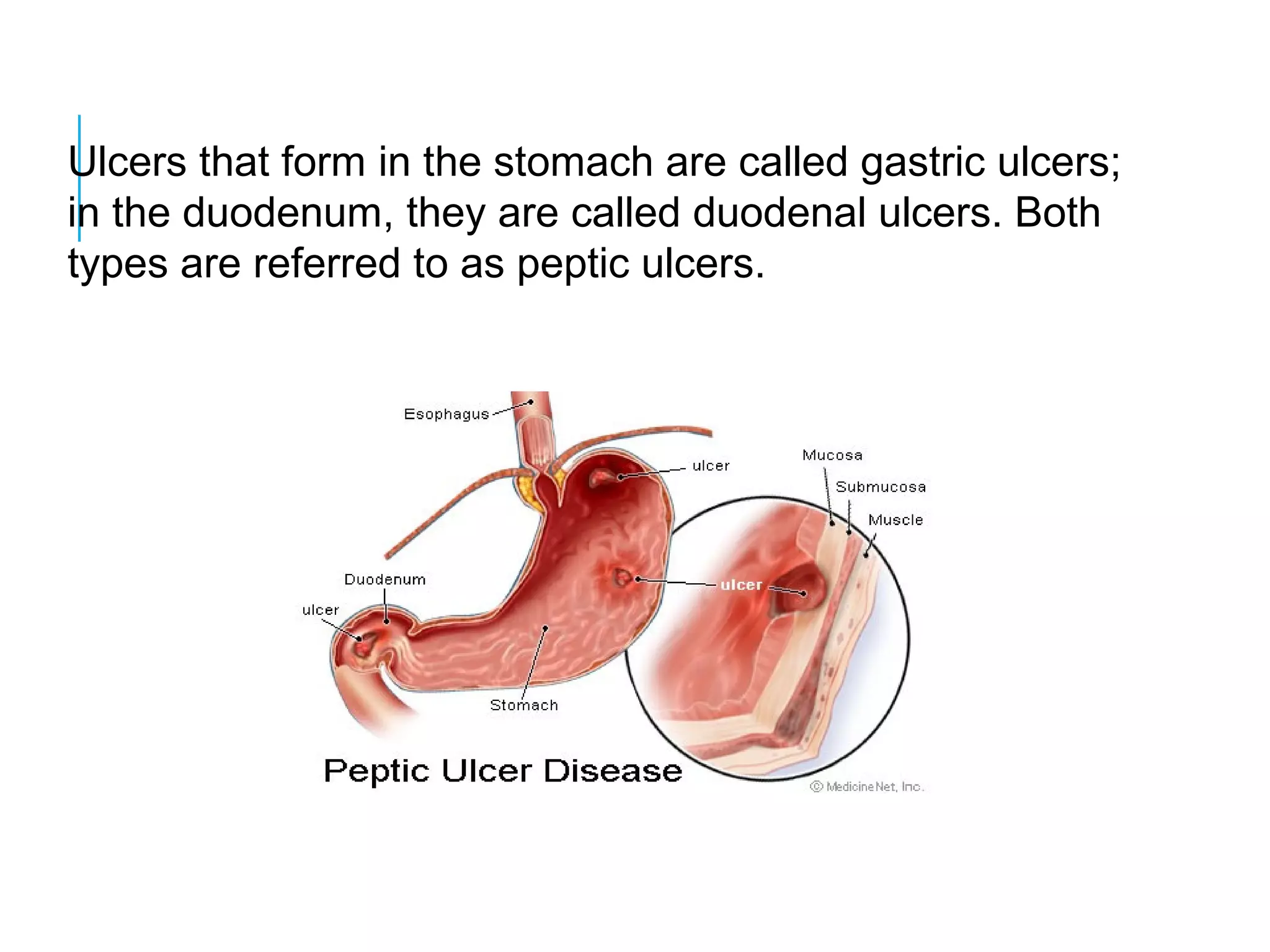 Pharmacology of anti ulcer drugs | PPT