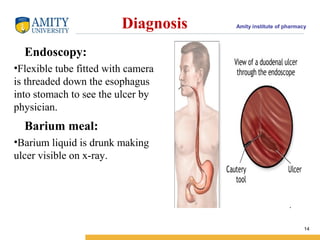 Amity institute of pharmacyDiagnosis
14
Endoscopy:
•Flexible tube fitted with camera
is threaded down the esophagus
into stomach to see the ulcer by
physician.
Barium meal:
•Barium liquid is drunk making
ulcer visible on x-ray.
 