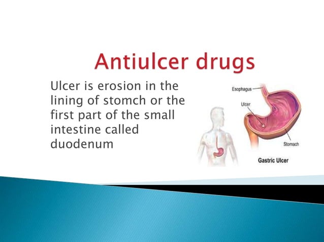 Antiulcer drugs | PPT