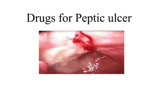Drugs for Peptic ulcer
 