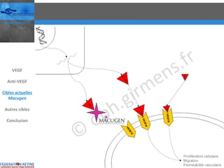 VEGF Anti-VEGF Cibles actuelles Macugen Autres cibles Conclusion 