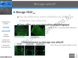 Blocage sélectif Blocage VEGF 165 Pas de différence entre inhibition du VEGF 164  et inhibition non sélective Sans effet sur vascularisation physiologique Ishida S. & al. J Exp Med 2003;198:483-9 Contrairement au blocage non sélectif Inai T & al. Am J Pathol 2004;1:35-52 Angiogenèse & VEGF Anti-VEGF Cible actuelle Autres stratégies Autres anti-angiogéniques Conclusion & perspectives 
