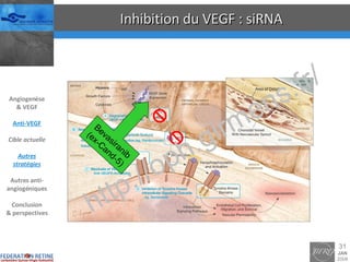 Inhibition du VEGF : siRNA Bevasiranib (ex-Cand-5) Angiogenèse & VEGF Anti-VEGF Cible actuelle Autres stratégies Autres anti-angiogéniques Conclusion & perspectives 