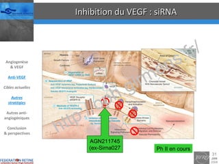 Inhibition du VEGF : siRNA AGN211745 (ex-Sirna027 Ph II en cours Angiogenèse & VEGF Anti-VEGF Cibles actuelles Autres stratégies Autres anti-angiogéniques Conclusion & perspectives 
