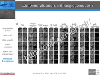 Combiner plusieurs anti-angiogéniques ? Angiogenèse & VEGF Anti-VEGF Cible actuelle Autres stratégies Autres anti-angiogéniques Conclusion & perspectives Dorrell MI & al.  PNAS 2007;104(3):967-972  . 