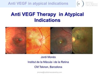jmones@institutmacularetina.com Anti VEGF Therapy  in Atypical Indications Jordi Monés Institut de la Màcula i de la Retina CM Teknon, Barcelona 