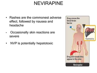 NEVIRAPINE
• Rashes are the commonest adverse
effect, followed by nausea and
headache
• Occasionally skin reactions are
severe
• NVP is potentially hepatotoxic
 
