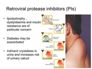 Retroviral protease inhibitors (PIs)
• lipodystrophy ,
dyslipidaemia and insulin
resistance are of
particular concern
• Diabetes may be
exacerbated
• Indinavir crystalises in
urine and increases risk
of urinary calculi
 