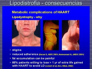 Lipodistrofia - consecuenciasLipodistrofia - consecuencias
 