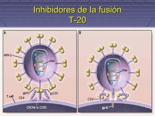 Inhibidores de la fusiónInhibidores de la fusión
T-20T-20
 
