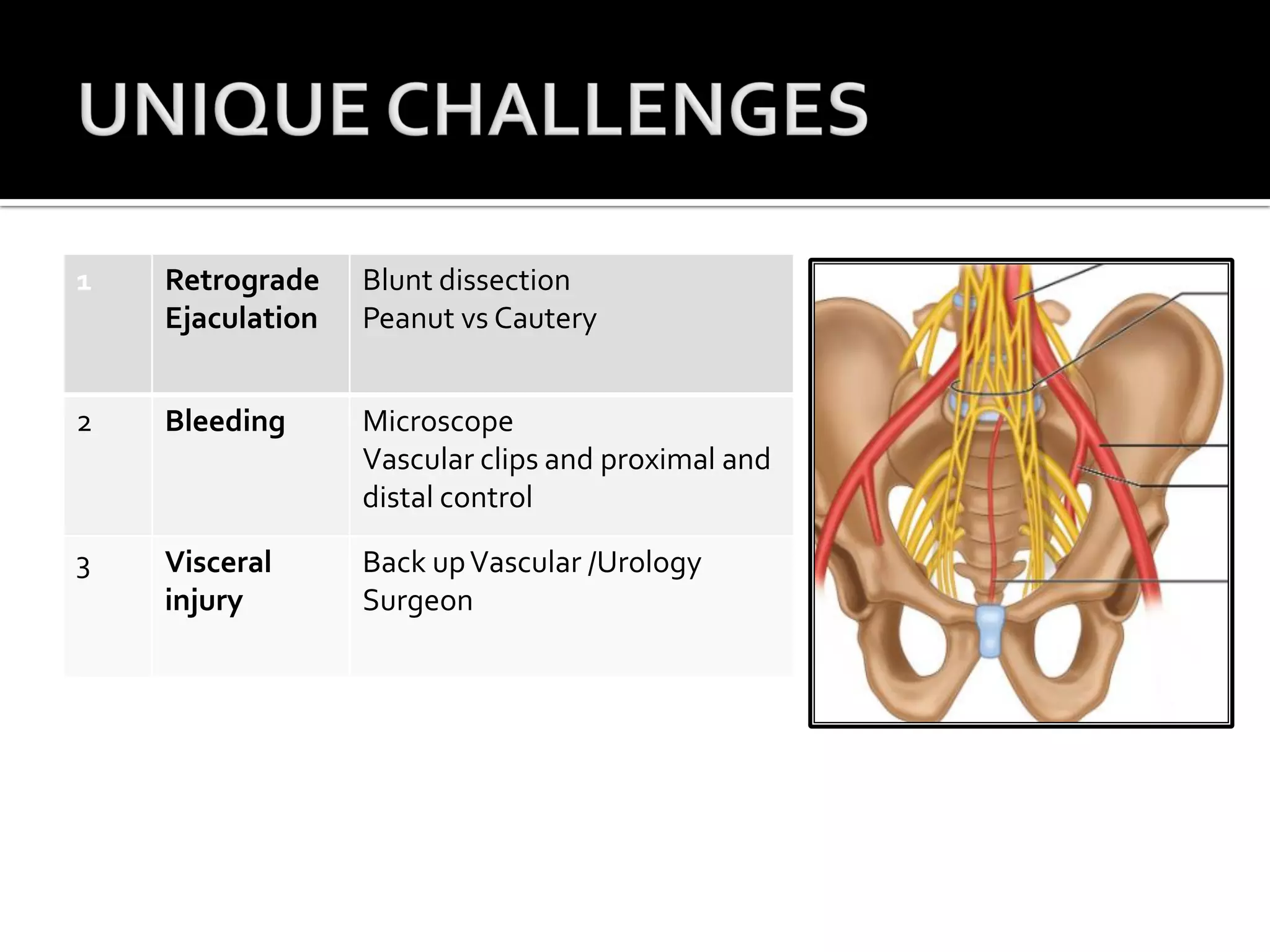 Anterior / lateral lumbar interbody Fusion | PDF