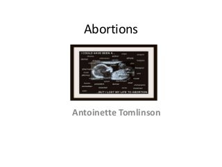 Abortions

Antoinette Tomlinson

 