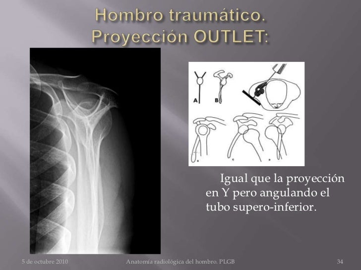 Antomia radiologica de la extremida superior