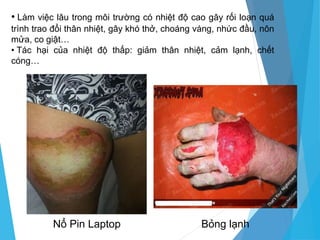 • Làm việc lâu trong môi trường có nhiệt độ cao gây rối loạn quá
trình trao đổi thân nhiệt, gây khó thở, choáng váng, nhức đầu, nôn
mửa, co giật…
• Tác hại của nhiệt độ thấp: giảm thân nhiệt, cảm lạnh, chết
cóng…
Bỏng lạnh
Nổ Pin Laptop
 