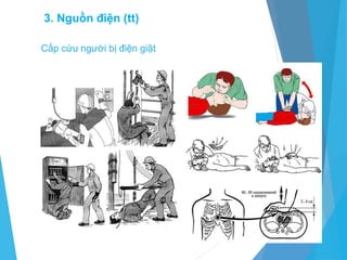 Cấp cứu người bị điện giật
45
3. Nguồn điện (tt)
 