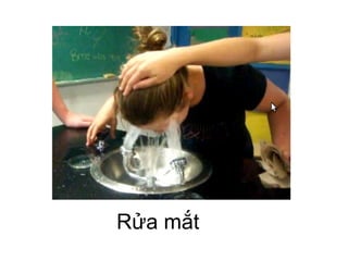 Rửa mắt
 