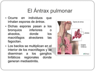 El Ántrax pulmonar
 Ocurre en individuos que
inhalan esporas de ántrax.
 Dichas esporas pasan a los
bronquios inferiores o
alveolos, donde los
macrófagos alveolares las
fagocitan.
 Los bacilos se multiplican en el
interior de los macrófagos y se
diseminan a los ganglios
linfáticos regionales donde
generan mediastinitis.
 