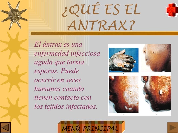 Antrax Antrax