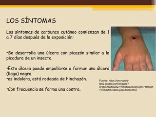 Antrax cabras | PPT