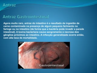 Agora muito raro, antraz do intestino é o resultado da ingestão de
carne contaminada na presença de algum pequeno ferimento na
faringe ou no intestino (de forma que a bactéria pode invadir a parede
intestinal). A toxina bacteriana causa sangramento e necrose dos
gânglios próximos ao intestino. A infecção generalizada ocorre então,
com alta taxa de mortalidade.
 