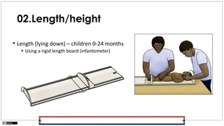 02.Length/height
• Length (lying down) – children 0-24 months
 Using a rigid length board (infantometer)
 