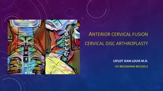 ANTERIOR CERVICAL FUSION
CERVICAL DISC ARTHROPLASTY
LEFLOT JEAN-LOUIS M.D.
UH BRUGMANN BRUSSELS
 