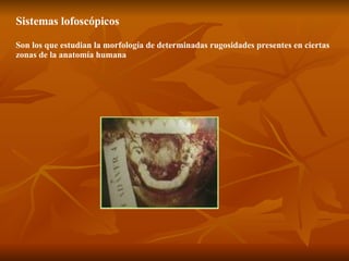 Sistemas lofoscópicos Son los que estudian la morfología de determinadas rugosidades presentes en ciertas zonas de la anatomía humana   