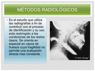 MÉTODOS RADIOLÓGICOS
• Es el estudio que utiliza
las radiografías a fin de
contribuir con el proceso
de identificación y su uso
esta restringido a las
condiciones de los restos
óseos. Se orienta en
especial en casos de
huesos cuya fragilidad no
permite una evaluación
directa mas constante.
 