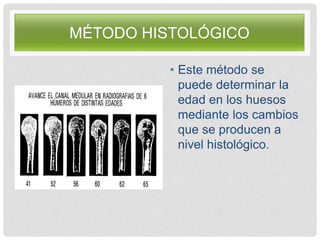 MÉTODO HISTOLÓGICO
• Este método se
puede determinar la
edad en los huesos
mediante los cambios
que se producen a
nivel histológico.
 
