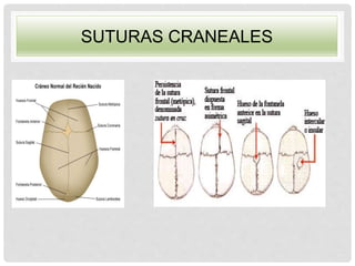 SUTURAS CRANEALES
 