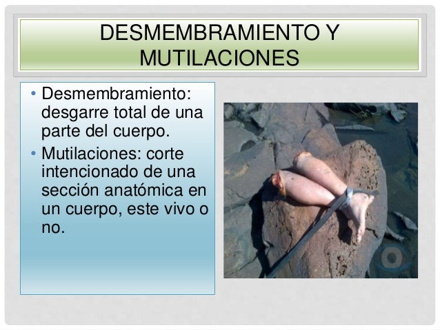 Antropología forense ( identidad e Identificacion)
