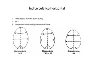 Índice cefálico horizontal
100 x largura máxima (Eurio-Eurio)
Ich =
comprimento máximo (glabelaopistocrânio)
 