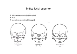 Índice facial superior
100 x altura máxima (próstio-násio)
Ifs =
comprimento máximo (zigio-zigio)
 