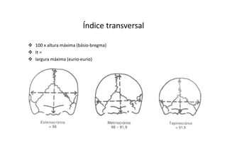 Índice transversal
100 x altura máxima (básio-bregma)
It =
largura máxima (eurio-eurio)
 