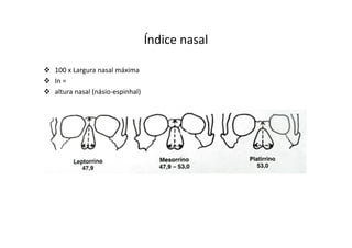 Índice nasal
100 x Largura nasal máxima
In =
altura nasal (násio-espinhal)
 