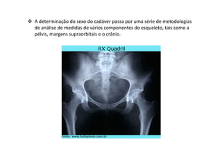 A determinação do sexo do cadáver passa por uma série de metodologias
de análise de medidas de vários componentes do esqueleto, tais como a
pélvis, margens supraorbitais e o crânio.
 
