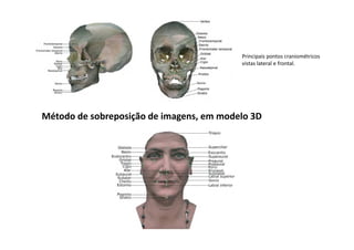 Principais pontos craniométricos
vistas lateral e frontal.
Método de sobreposição de imagens, em modelo 3D
 