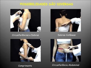Circunferências e Dobras
Circunferência Abdominal
Comprimento
Dobras Cutâneas
POSSIBILIDADES SÃO DIVERSAS
 