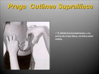 Prega Cutânea Suprailíaca
 É obtida horizontalmente 1 cm
acima da crista ilíaca, na linha axilar
média.
 