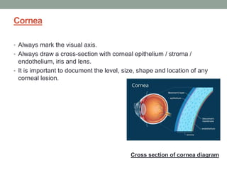 Cornea
• Always mark the visual axis.
• Always draw a cross-section with corneal epithelium / stroma /
endothelium, iris and lens.
• It is important to document the level, size, shape and location of any
corneal lesion.
Cross section of cornea diagram
 
