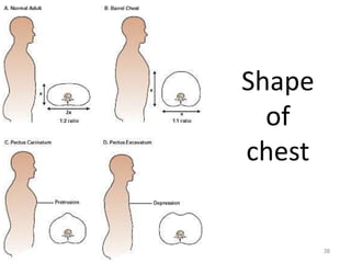 Shape 
of 
chest 
38 
 